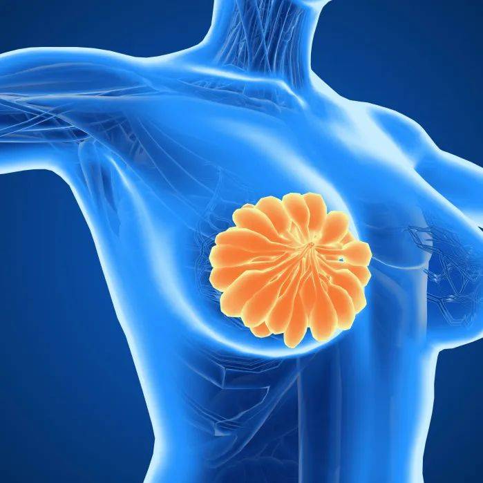 Can Breast Nodules Develop into Breast Cancer You Need to Kn